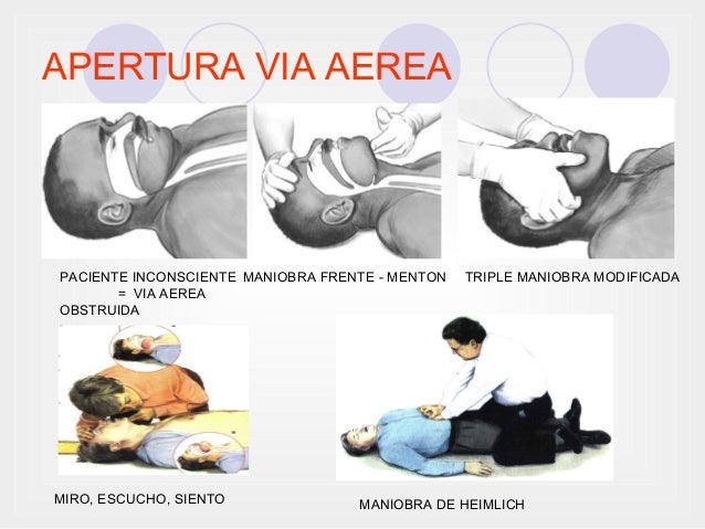 T cnicas Para Abrir La V a A rea ZZZAC t-cnicas-para-abrir-la-v-a-a-rea-zzzac