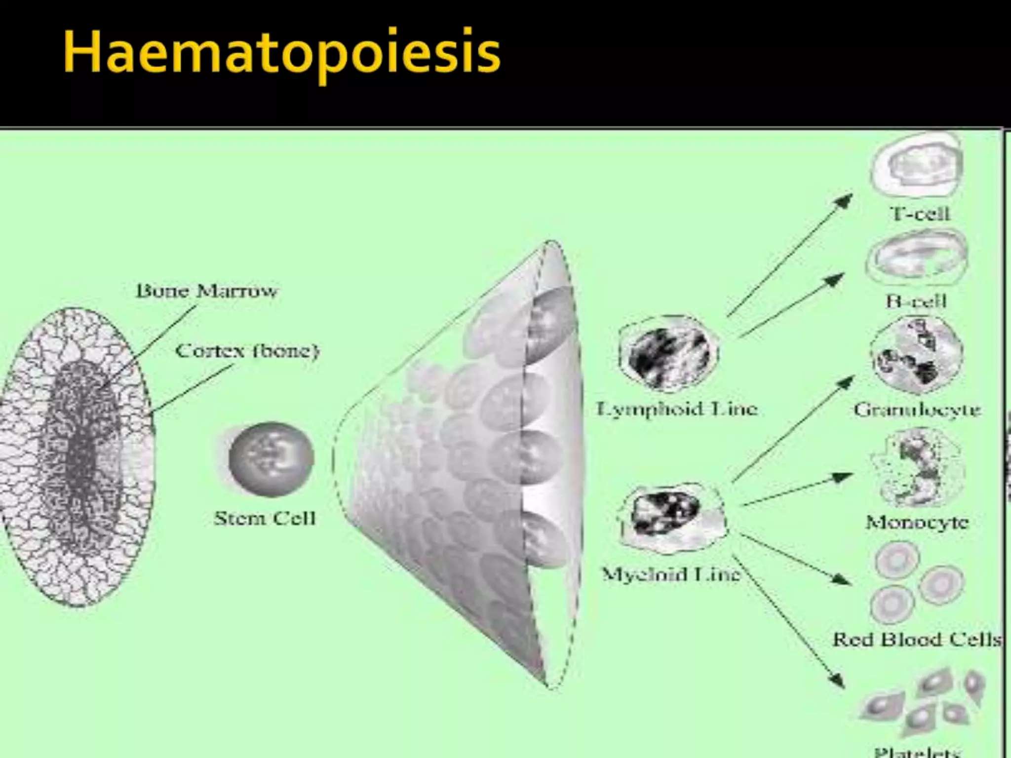 Image showcasing Leukemias-basic pathology | PPTX