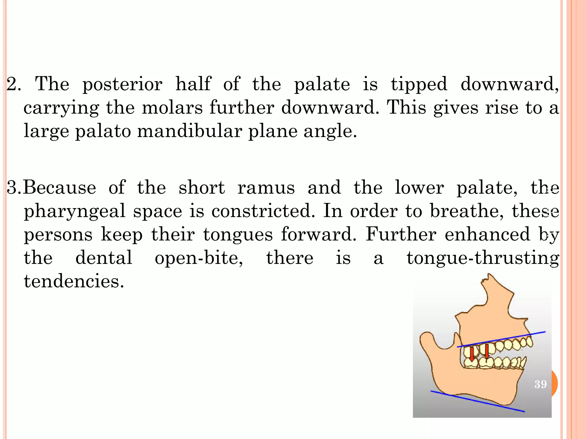 Mangement of openbite in orthodontics | PDF
