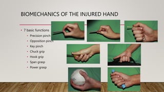 Mangled and Burned Hand.pptx