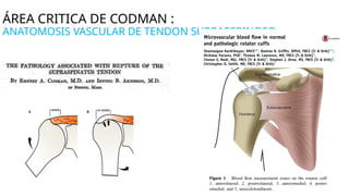 Tendonitis Codman RUPTURA MANGUITO ROTADOR DR. ALEJANDRO MONROY CALDERON | PPTX