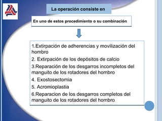 La operación consiste en
En uno de estos procedimiento o su combinación
1.Extirpación de adherencias y movilización del
hombro
2. Extirpación de los depósitos de calcio
3.Reparación de los desgarros incompletos del
manguito de los rotadores del hombro
4. Exostosectomia
5. Acromioplastia
6.Reparacion de los desgarros completos del
manguito de los rotadores del hombro
 