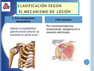Debido a inestabilidad
glenohumeral anterior; s
e
presenta en gente joven
2. Por compresión
secundaria:
3.Por tensión
CLASIFICACIÓN SEG ÚN
EL M E C A N I S M O D E LESIÓN
Por microtraumatismos
ocasionando desgarros en a
inserción del bíceps.
 