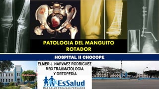 PATOLOGIA DEL MANGUITO
ROTADOR
ELMER J. NARVAEZ RODRIGUEZ
MR3 TRAUMATOLOGIA
Y ORTOPEDIA
 