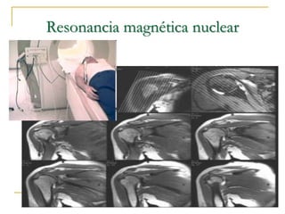 Resonancia magnética nuclear
 
