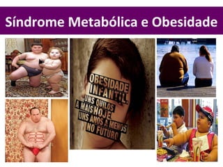 Síndrome Metabólica e Obesidade
 