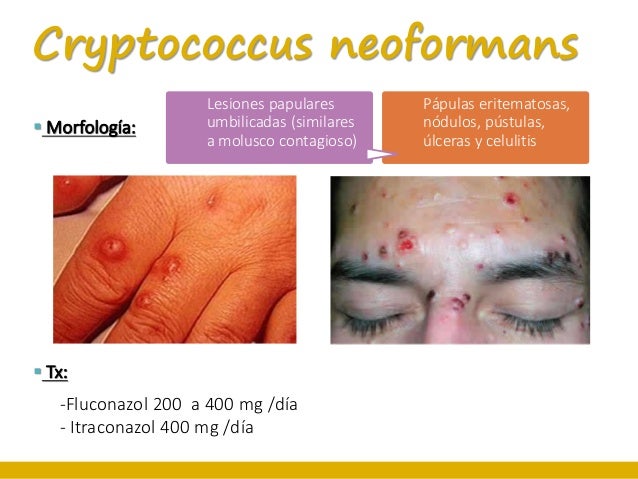 buy xenical online canada