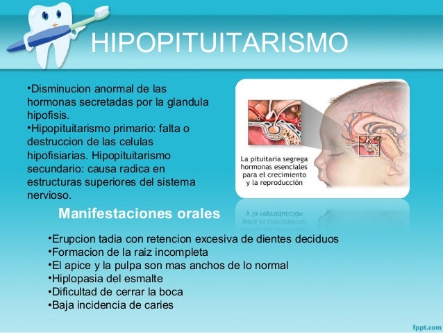 Manifestaciones orales en Enfermedades Endocrinas-Diabetes Manifestaciones orales en Enfermedades Endocrinas-Diabetes