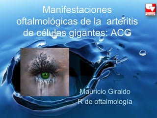 Manifestaciones
oftalmológicas de la arteritis
de células gigantes: ACG
Mauricio Giraldo
R de oftalmología
 