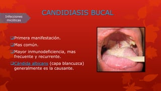 Capa Recurrente Manifestaciones bucales del vih | PPTX