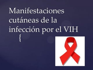 Manifestaciones
cutáneas de la
infección por el VIH
  {
 