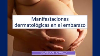 Manifestaciones
dermatológicas en el embarazo
MELANIE CASTRO MOLLO
 