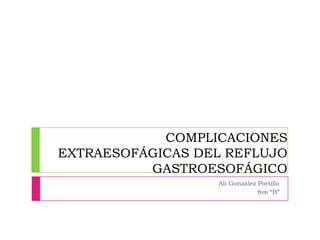 COMPLICACIONES
EXTRAESOFÁGICAS DEL REFLUJO
GASTROESOFÁGICO
Alí González Portillo
8vo “B”

 