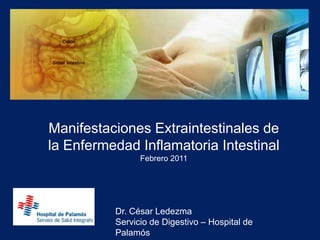 Manifestaciones Extraintestinales de la Enfermedad Inflamatoria Intestinal Febrero 2011 Dr. César Ledezma Servicio de Digestivo – Hospital de Palamós 