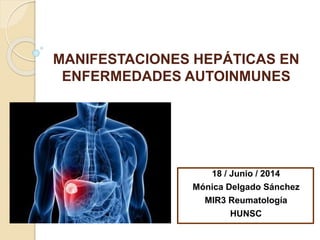MANIFESTACIONES HEPÁTICAS EN
ENFERMEDADES AUTOINMUNES
18 / Junio / 2014
Mónica Delgado Sánchez
MIR3 Reumatología
HUNSC
 