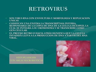 Retrotranscriptasa Inversa Manifestaciones orales del sida. | PDF
