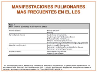 Manifestaciones pulmonares del lupus eritematoso sistémico | PPTX