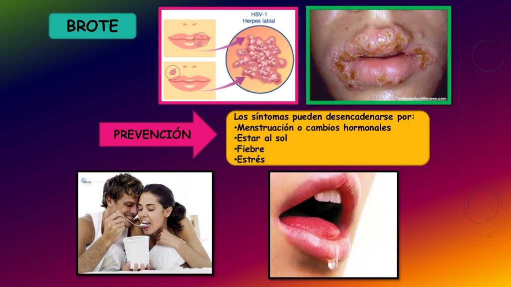 Manifestacion oral de enfermedades virales en niños