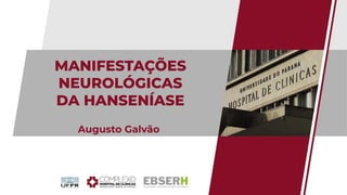 MANIFESTAÇÕES
NEUROLÓGICAS
DA HANSENÍASE
Augusto Galvão
 