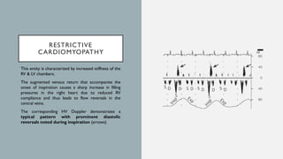 Manifestations of Cardiovascular Disorders on Doppler Interrogation of ...