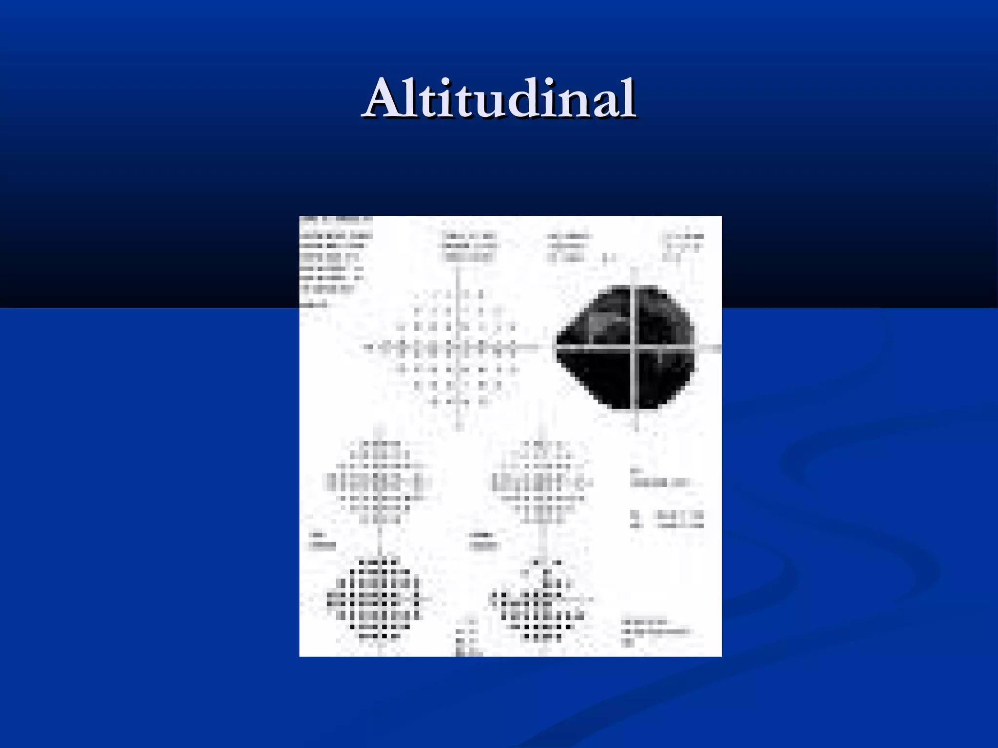 AltitudinalAltitudinal
 