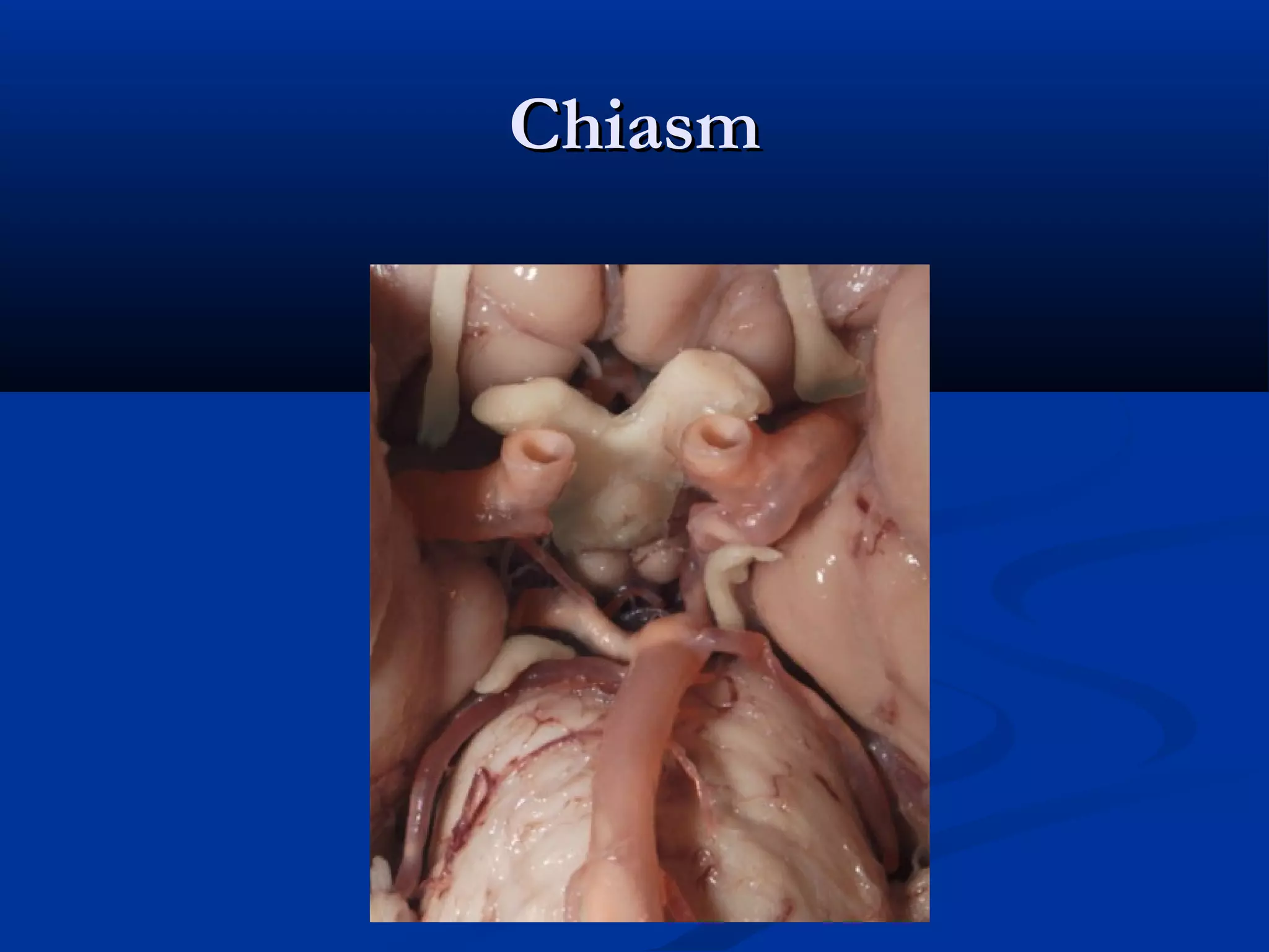 ChiasmChiasm
 