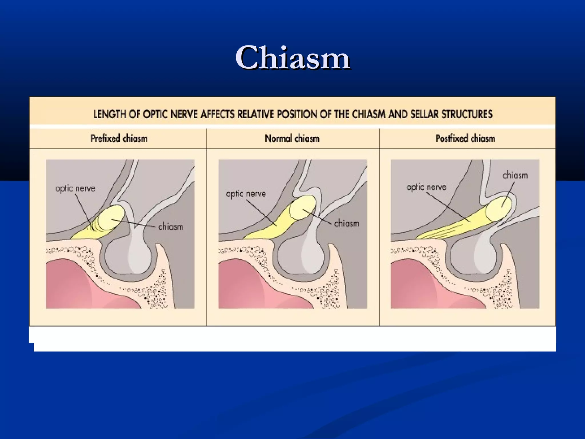 ChiasmChiasm
 
