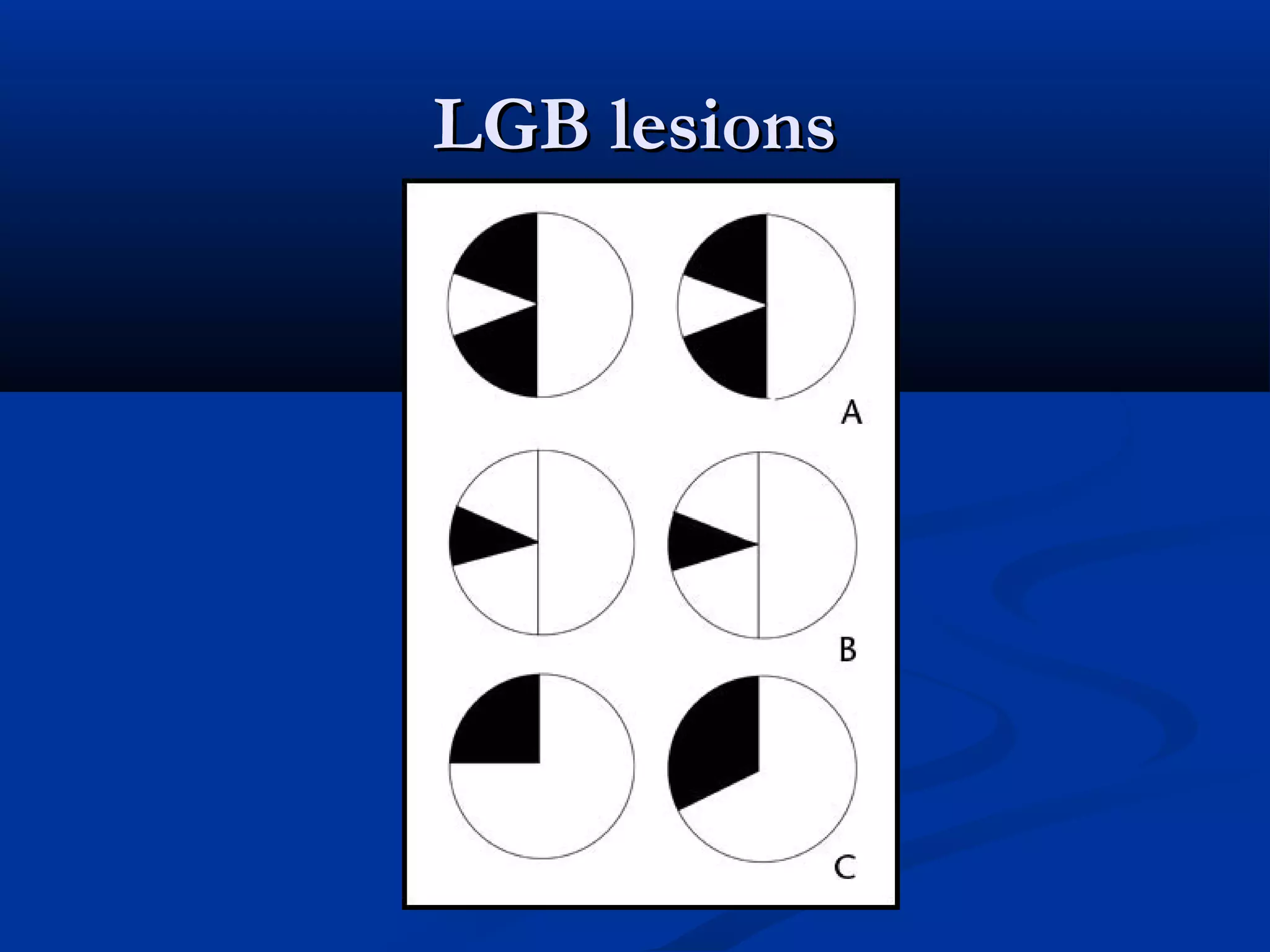 LGB lesionsLGB lesions
 