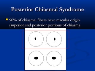 Manifestations of visual pathway lesions | PPT