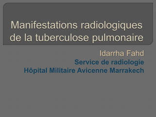 Idarrha Fahd
Service de radiologie
Hôpital Militaire Avicenne Marrakech
 