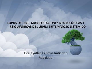 LUPUS DEL SNC: MANIFESTACIONES NEUROLÓGICAS Y
 PSIQUIÁTRICAS DEL LUPUS ERITEMATOSO SISTÉMICO




         Dra. Cynthia Cabrera Gutiérrez.
                   Psiquiatra.
 