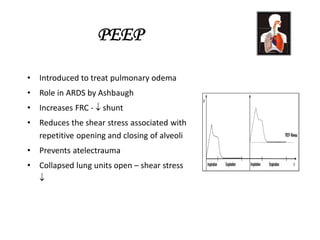 PEEP
• Introduced to treat pulmonary odema
• Role in ARDS by Ashbaugh
• Increases FRC -  shunt
• Reduces the shear stress associated with
repetitive opening and closing of alveoli
• Prevents atelectrauma
• Collapsed lung units open – shear stress

 