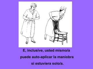 E, inclusive, usted mismo/a  puede auto-aplicar la maniobra si estuviera solo/a. 