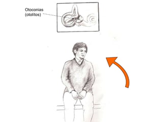 Otoconias
(otolítos)
 
