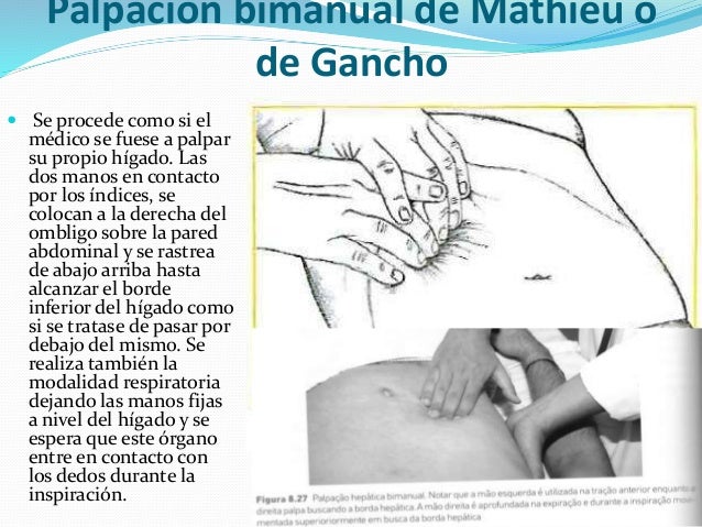 Maniobras abdominales