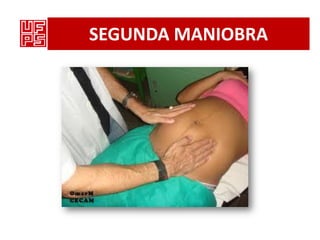 SEGUNDA MANIOBRA
 
