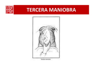 TERCERA MANIOBRA
 