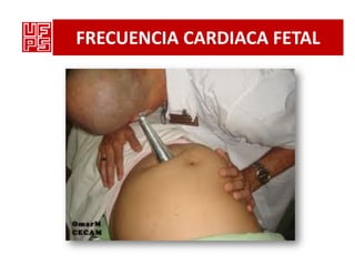 FRECUENCIA CARDIACA FETAL
 