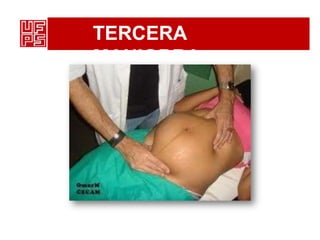 TERCERA
MANIOBRA
 