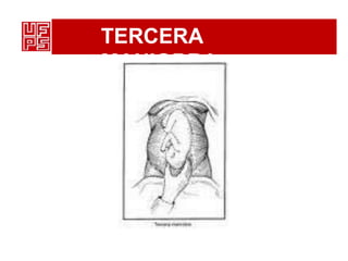 TERCERA
MANIOBRA
 