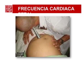 FRECUENCIA CARDIACA
FETAL
 