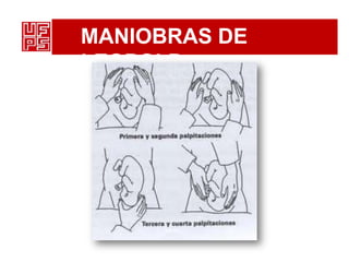 MANIOBRAS DE
LEOPOLD
 