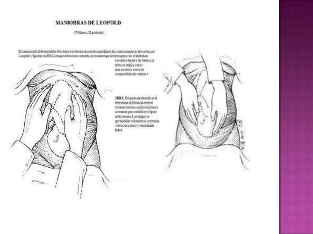 Maniobras de leopold
