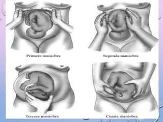 Maniobras de leopold