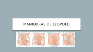 MANIOBRAS DE LEOPOLD
 