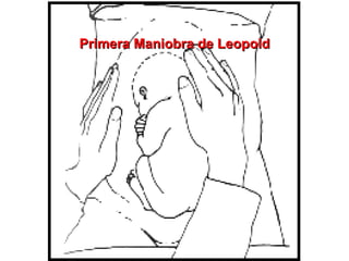 Primera Maniobra de Leopold 