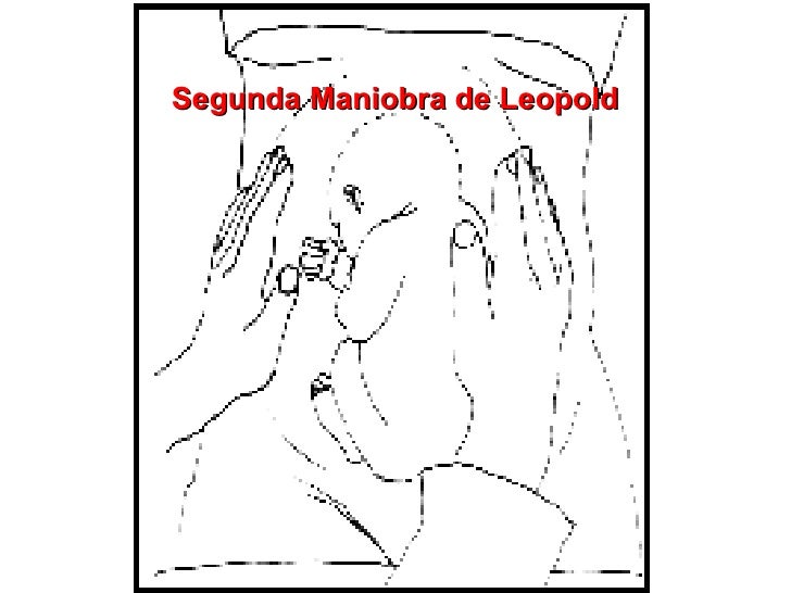 Maniobras De Parto[1]