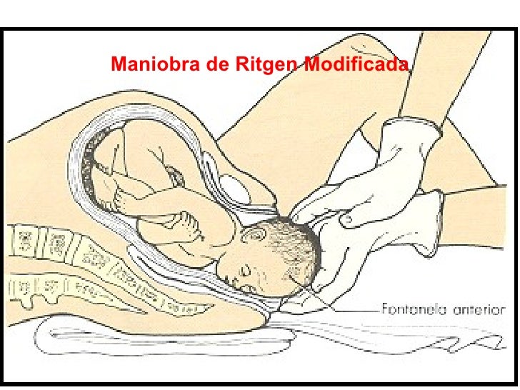 Maniobras De Parto[1]