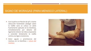 SIGNO DE MORAGAS (PARA MENISCO LATERAL)
 Con la pierna en flexión de 90º y fuerte
abducción haciéndola cabalgar sobre
la rodilla sana se coloca un dedo
fuertemente aplicado en la interlínea,
inmediatamente por delante del
ligamento lateral. Se indica al paciente
a extender lentamente la rodilla
contra una ligera resistencia.
 Dolor agudo y prominencia del
menisco en la interlínea = rotura del
menisco
 