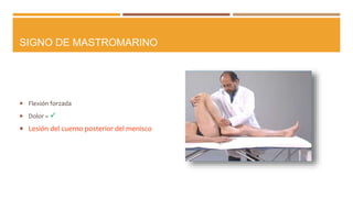 SIGNO DE MASTROMARINO
 Flexión forzada
 Dolor = 
 Lesión del cuerno posterior del menisco
 